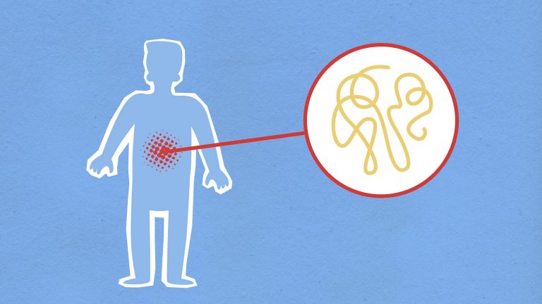 inflamación crónica de bajo grado