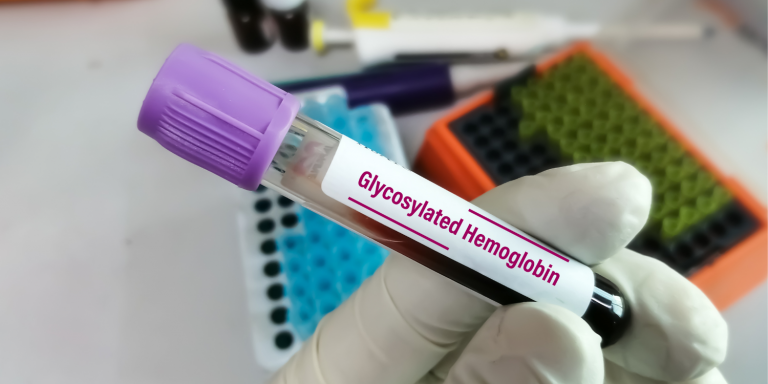hemoglobina glicosilada analítica importante